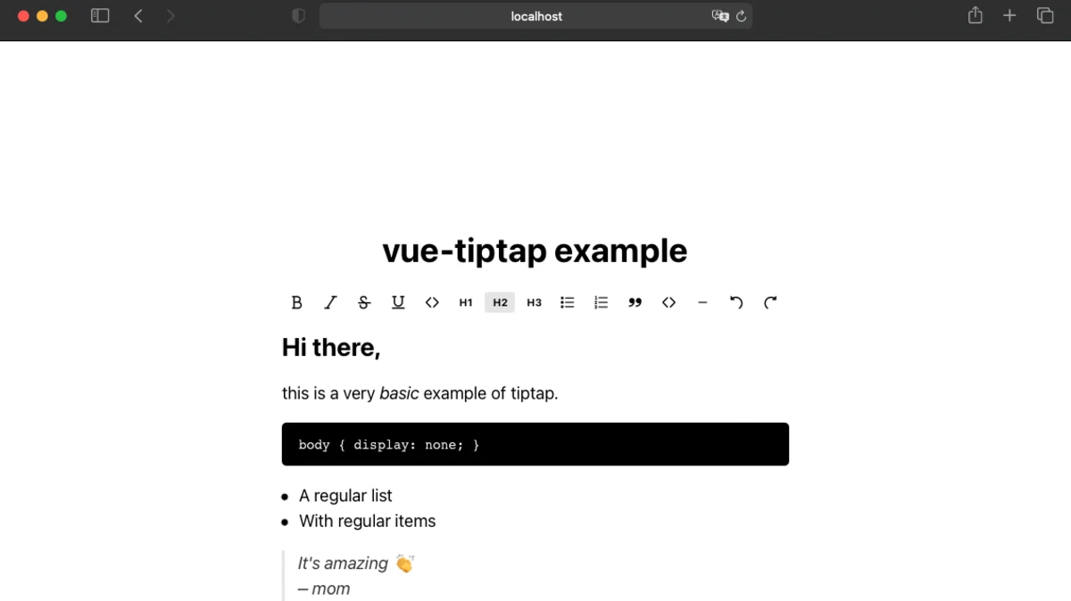 Vue components